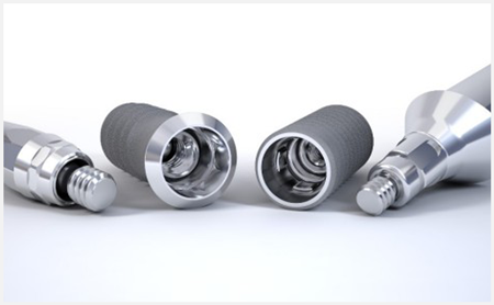 インプラントについて